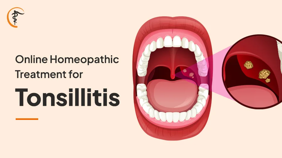 Online Homeopathic Treatment for Tonsillitis - Satyam Homeopathy